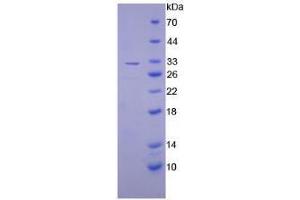 SDS-PAGE analysis of Mouse PAI2 Protein. (SERPINB2 蛋白)