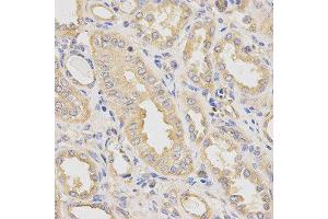 Immunohistochemistry of paraffin-embedded human kidney using DCTN2 antibody at dilution of 1:200 (x400 lens) (Dynamitin 抗体  (AA 50-320))