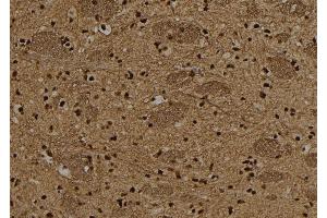 ABIN6265487 and ABIN6278641 at 1/100 staining Rat brain tissue by IHC-P. (T-Box 15/18 抗体  (Internal Region))