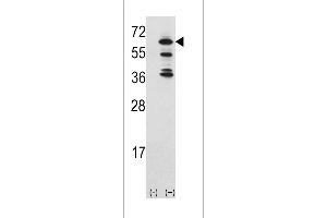 Western blot analysis of ACK1 (arrow) using rabbit polyclonal ACK1 Antibody (Center) (ABIN392084 and ABIN2841843). (TNK2 抗体  (AA 383-411))