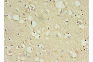 Immunohistochemistry of paraffin-embedded human brain tissue using ABIN7176501 at dilution of 1:100 (ZNF699 抗体  (AA 19-195))