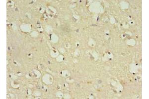 Immunohistochemistry of paraffin-embedded human brain tissue using ABIN7176501 at dilution of 1:100 (ZNF699 抗体  (AA 19-195))