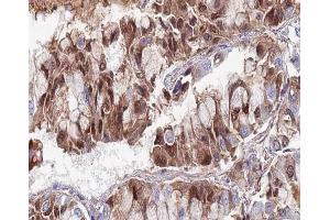 Immunohistochemistry (IHC) image for anti-SUMO1/sentrin Specific Peptidase 5 (SENP5) antibody (ABIN6264986)