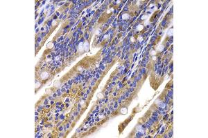 Immunohistochemistry of paraffin-embedded mouse ileum using HDGFRP2 antibody (ABIN5975300) at dilution of 1/100 (40x lens). (HDGFRP2 抗体)