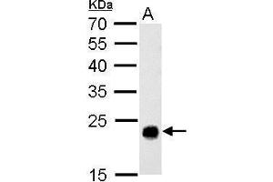 Western Blotting (WB) image for anti-Glutathione S-Transferase theta 1 (GSTT1) antibody (ABIN2856663)