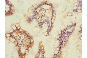 Immunohistochemistry of paraffin-embedded human small intestine tissue using ABIN7170777 at dilution of 1:100
