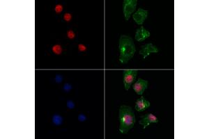 ABIN7093949 and ABIN7097993 staining Hela cells by IF/ICC. (EGLN3 抗体  (Internal Region))