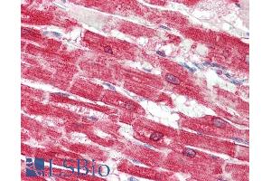 Immunohistochemistry (IHC) image for anti-ATPase, Ca++ Transporting, Cardiac Muscle, Slow Twitch 2 (ATP2A2) (Internal Region) antibody (ABIN1686784)