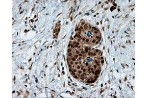 Immunohistochemical staining of paraffin-embedded liver tissue using anti-LTA4H mouse monoclonal antibody. (LTA4H 抗体)