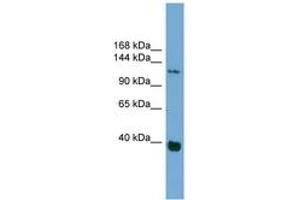 Image no. 1 for anti-Catenin (Cadherin-Associated Protein), delta 1 (CTNND1) (AA 827-876) antibody (ABIN6744923) (CTNND1 抗体  (AA 827-876))