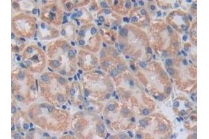 Immunohistochemistry (IHC) image for anti-Cyclin D2 (CCND2) (AA 47-267) antibody (ABIN7439681)