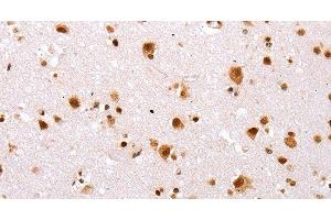 Immunohistochemistry of paraffin-embedded Human brain tissue using TBX2 Polyclonal Antibody at dilution 1:32 (TBX2 抗体)