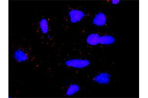 Proximity Ligation Analysis of protein-protein interactions between LCK and DLG1. (DLG1 抗体  (AA 1-90))