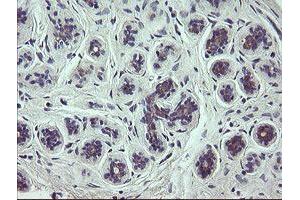 Immunohistochemical staining of paraffin-embedded Human breast tissue using anti-SCFD1 mouse monoclonal antibody. (SCFD1 抗体)