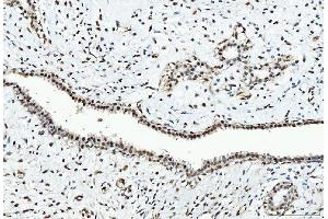 IHC analysis of CTBP2 using anti-CTBP2 antibody (ABIN7601325). (CTBP2 抗体  (AA 321-445))