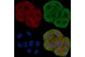 ABIN6258193 and ABIN6276039 staining Hela cells(30 min of UV treatment) by IF/ICC. (GPR83 抗体  (N-Term))