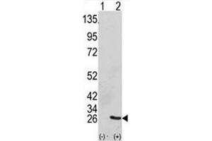 Western blot analysis of GRB2 antibody and 293 cell lysate (2 ug/lane) either nontransfected (Lane 1) or transiently transfected with the GRB2 gene (2). (GRB2 抗体  (AA 89-118))