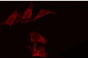 ABIN6266616 staining 293 by IF/ICC. (Patched 1 抗体  (N-Term))