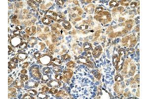 C3orf31 antibody was used for immunohistochemistry at a concentration of 4-8 ug/ml to stain Epithelial cells of renal tubule (arrows) in Human Kidney. (TAM41 抗体  (N-Term))