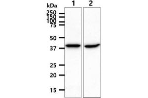 The cell lysate (40ug) were resolved by SDS-PAGE, transferred to PVDF membrane and probed with anti-human ACADS antibody (1:1000). (ACADS 抗体)