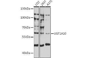 Western blot analysis of extracts of various cell lines, using UGT1 antibody (ABIN7271191) at 1:1000 dilution. (UGT1A10 抗体  (AA 50-150))