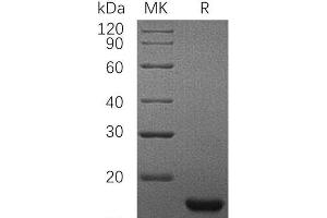 KIT Ligand Protein (KITLG) (His tag)
