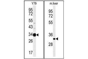 Western blot analysis: AIG1 Antibody staining of Mouse liver tissue lysates (Right) and Y79 cell line lysates (Left) (35 ug/lane). (AIG1 抗体  (N-Term))
