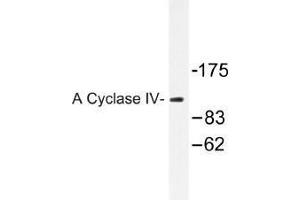 Image no. 1 for anti-Adenylate Cyclase 4 (ADCY4) antibody (ABIN317941) (ADCY4 抗体)