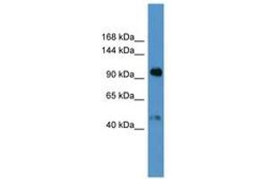 Image no. 1 for anti-Apolipoprotein A (APOA) (AA 3653-3702) antibody (ABIN6746794) (LPA 抗体  (AA 3653-3702))