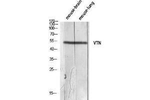 Western Blot (WB) analysis of Mouse Brain Mouse Lung lysis using VTN antibody. (Vitronectin 抗体)