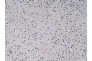IHC-P analysis of Mouse Brain Tissue, with DAB staining. (IL-2 抗体  (AA 10-169))