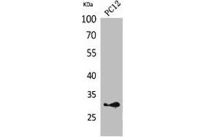Western Blot analysis of PC12 cells using HLA-DQB1/2 Polyclonal Antibody. (HLA-DQB2 抗体  (Internal Region))