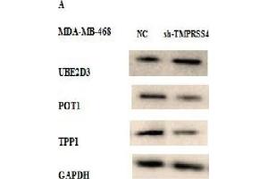 Western Blot Analysis was Performed to Study the Effect of TMPRSS4 Expression Modulation on Telomere Integrity in Stably Transfected MDA-MB-468 and MCF-7 Cell Lines by Analyzing the Expression of Certain Proteins Related to Telomere Maintenance (UBE2D3, POT1, and TPP1). (TPP1 抗体  (AA 284-563))