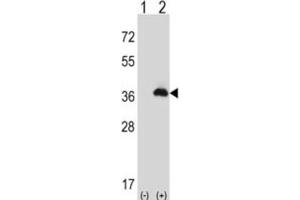 Western Blotting (WB) image for anti-Peroxisomal Biogenesis Factor 16 (PEX16) antibody (ABIN3004053) (PEX16 抗体)