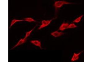 ABIN6274939 staining NIH-3T3 by IF/ICC. (CAPN12 抗体  (Internal Region))