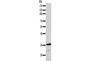 Gel: 10 % SDS-PAGE, Lysate: 40 μg, Lane: MCF7 cells, Primary antibody: ABIN7131278(SYT9 Antibody) at dilution 1/200, Secondary antibody: Goat anti rabbit IgG at 1/8000 dilution, Exposure time: 1 minute (SYT9 抗体)