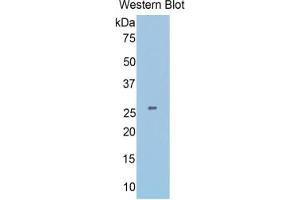 Western Blotting (WB) image for Slit Homolog 1 (SLIT1) ELISA Kit (ABIN6574315)