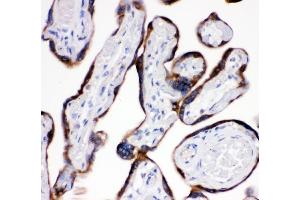 IHC analysis of AEBP2 using anti-AEBP2 antibody (ABIN4886435). (AEBP2 抗体  (AA 424-517))