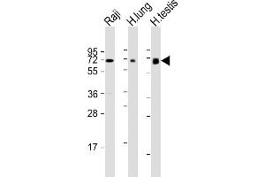 All lanes : Anti-ERVK-7 Antibody (N-Term) at 1:1000-1:2000 dilution Lane 1: Raji whole cell lysate Lane 2: human lung lysate Lane 3: human testis lysate Lysates/proteins at 20 μg per lane.