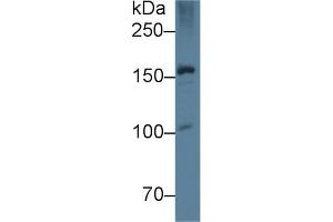 Western Blot; Sample: Rat Liver lysate; Primary Ab: 5µg/ml Mouse Anti-Rat APOB Antibody Second Ab: 0. (APOB 抗体  (AA 2747-2913))