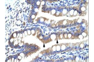 Image no. 1 for anti-Chloride Intracellular Channel 5 (CLIC5) (AA 230-279) antibody (ABIN202457) (CLIC5 抗体  (AA 230-279))