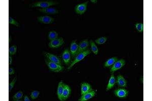Immunofluorescent analysis of HepG2 cells using ABIN7170251 at dilution of 1:100 and Alexa Fluor 488-congugated AffiniPure Goat Anti-Rabbit IgG(H+L) (SLC41A2 抗体  (AA 1-162))
