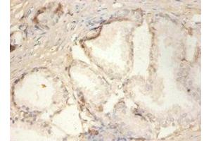 Immunohistochemistry (IHC) image for anti-Phospholipase A2, Group IIA (Platelets, Synovial Fluid) (PLA2G2A) (AA 21-144) antibody (ABIN7163321)