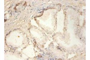 Immunohistochemistry of paraffin-embedded human prostate tissue using ABIN7163321 at dilution of 1:100 (PLA2G2A 抗体  (AA 21-144))
