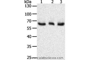 Western blot analysis of A375, Hela and Jurkat cell, using TYR Polyclonal Antibody at dilution of 1:400 (TYR 抗体)
