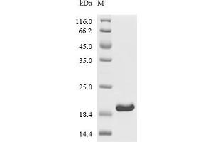 (Tris-Glycine gel) Discontinuous SDS-PAGE (reduced) with 5 % enrichment gel and 15 % separation gel.