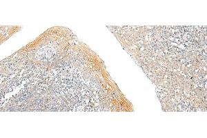 Immunohistochemistry of paraffin-embedded Human tonsil tissue using FAM110D Polyclonal Antibody at dilution of 1:60(x200) (GRRP1 抗体)