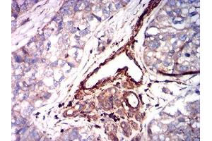 Immunohistochemistry (IHC) image for anti-Actin, alpha 2, Smooth Muscle, Aorta (ACTA2) (AA 2-124) antibody (ABIN7193571)