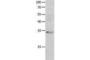 Western Blot analysis of Jurkat cell using RBFOX3 Polyclonal Antibody at dilution of 1:550