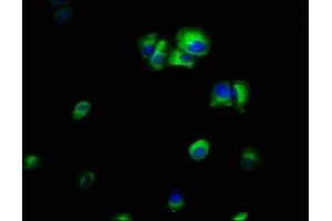 Immunofluorescence staining of MCF-7 cells with ABIN7156505 at 1:66, counter-stained with DAPI. (ILK 抗体  (AA 1-228))
